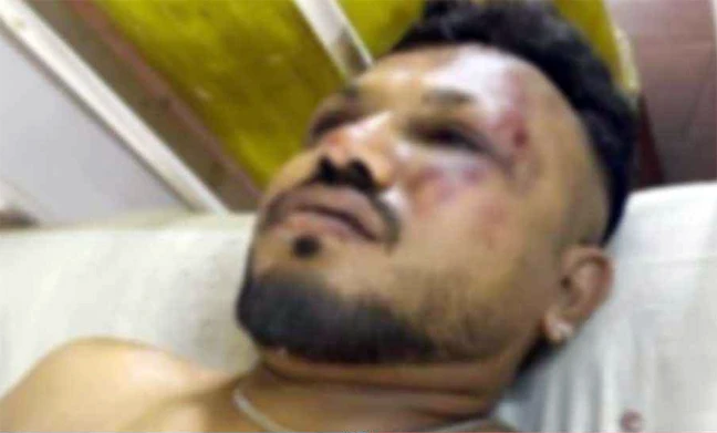 বিমান বিধ্বস্তে অলৌকিকভাবে বেঁচে গেলেন এক যুবক (ভিডিও)