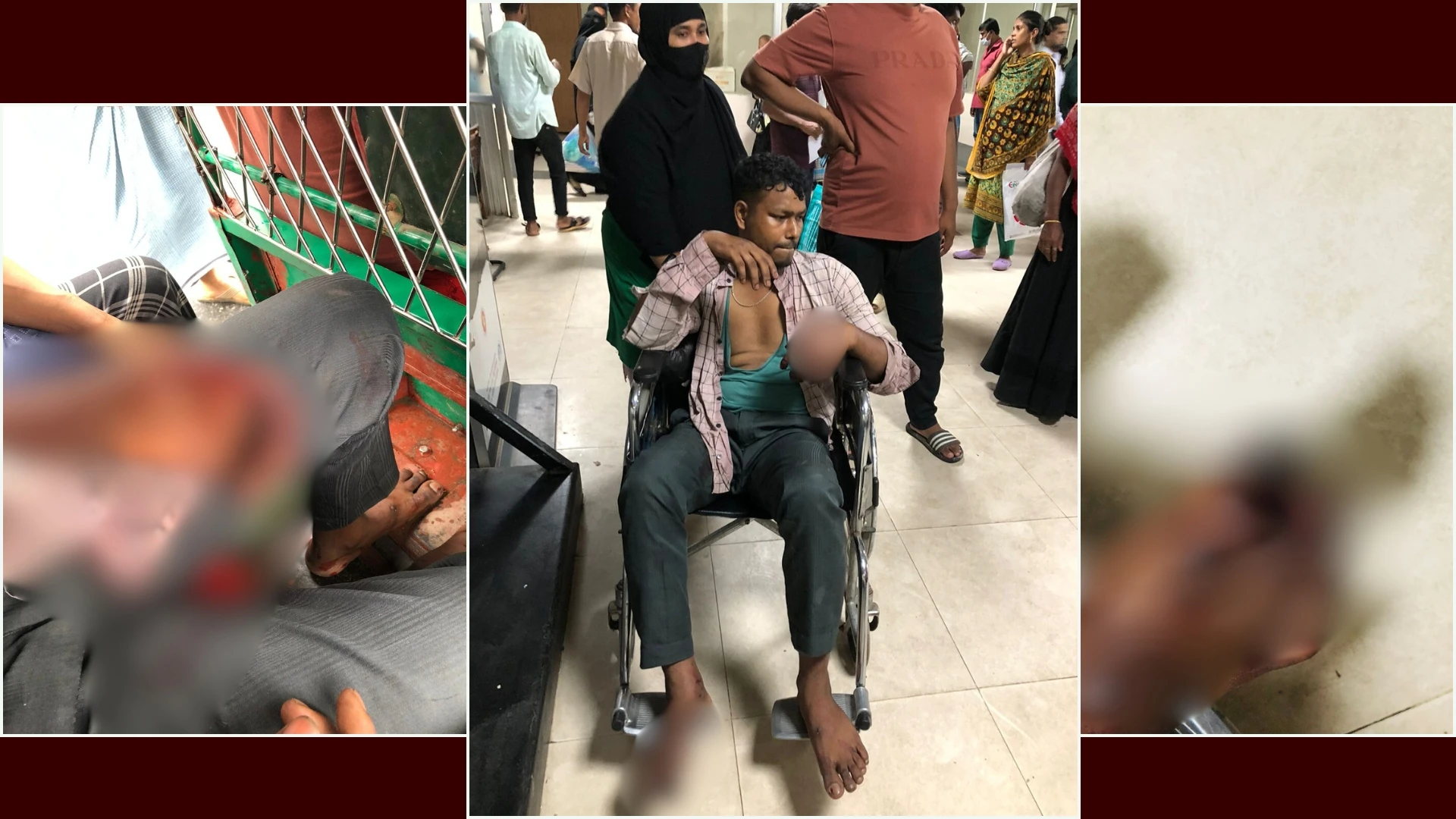 চোখ বেঁধে প্রেমিকের হাত-পায়ের নখ তুলে নিল পুরনো প্রেমিকার পরিবার