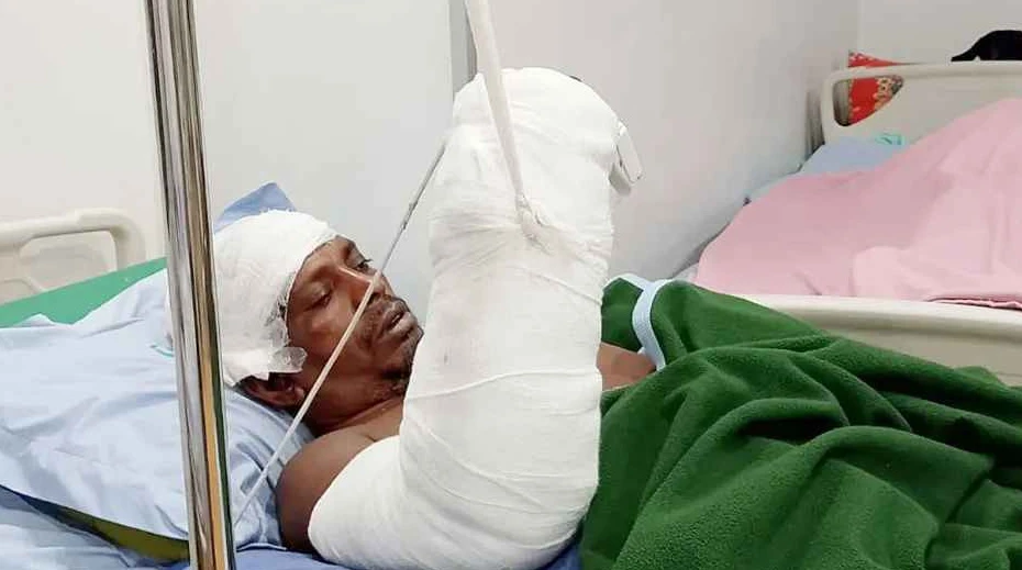 পলিথিনে আনা সেই বিচ্ছিন্ন হাত জোড়া লাগানো হলো সাড়ে ৩ ঘণ্টায়
