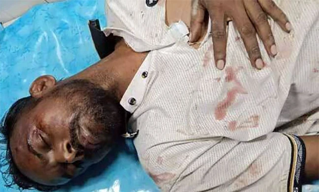 হিরো আলমের ওপর দুর্বৃত্তদের হামলা