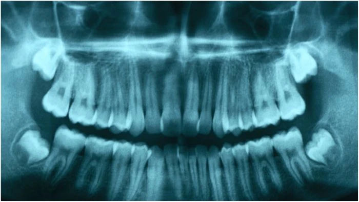 হারিয়ে যাওয়া দাঁত ফিরবে প্রাকৃতিকভাবে! চিকিৎসা বিজ্ঞানে নতুন দিগন্ত খুলল জাপান