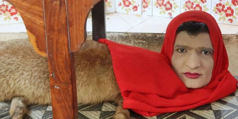 করাচির চিড়িয়াখানায় দেখা মিললো অর্ধেক মানুষ, অর্ধেক শেয়াল! আসল ঘটনা যা জানাগেল