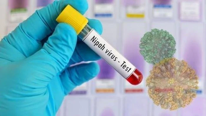 ভারতে নিপাহ ভাইরাসের প্রাদুর্ভাব: পাকিস্তানে হাই অ্যালার্ট জারি