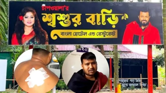 ওমর সানীর রেস্তোরাঁয় তর্কে জড়িয়ে কাস্টমারকে কুপিয়ে জখম, ১৩ জনের বিরুদ্ধে মামলা