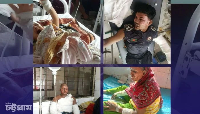 চীনে প্রশিক্ষণ নিয়েও চট্টগ্রাম মেডিকেলের বার্ন ইউনিটে নার্সের বদলে ওয়ার্ডবয়–আয়ার হাতে পোড়া রোগীর ড্রেসিং