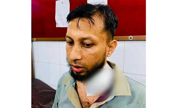 বাড়িতে বিদ্যুৎ না থাকায় বাইরে বসেছিলেন এসিল্যান্ড, কোপাল ডাকাতরা