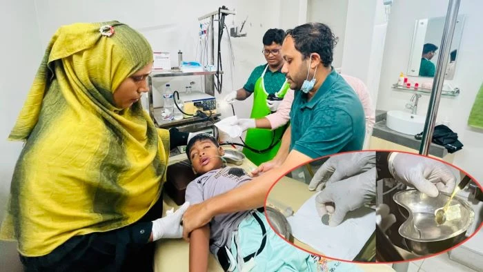 ফরিদপুরে ৭ বছরের শিশুর পাকস্থলীতে আটকে ছিল ৫ টাকার কয়েন