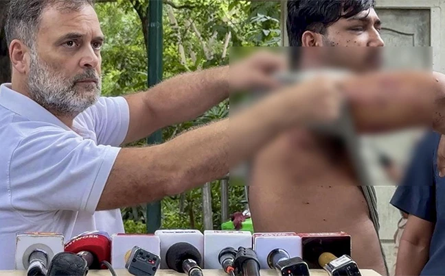 ‘গুলি চালিয়েও অস্বীকার’, মোদি সরকারের বিরুদ্ধে প্রমাণ দেখালেন রাহুল