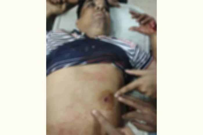 নোয়াখালীতে বিএনপি নেতাকে গুলি, লাগল সহযোগীর বুকে