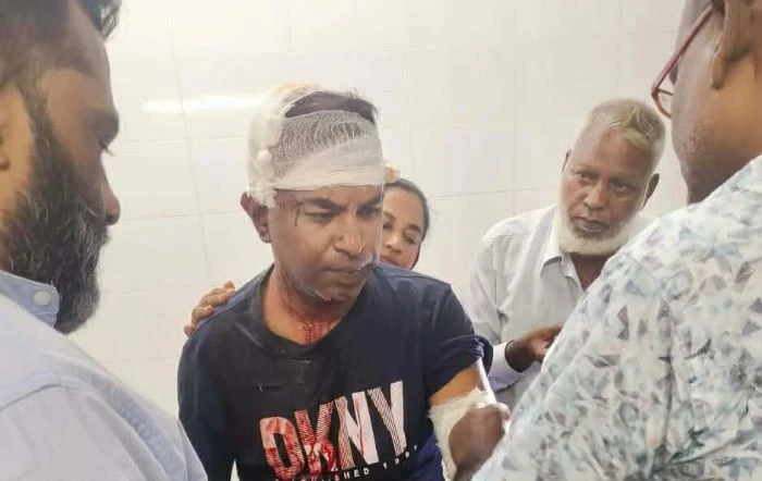 ফরিদপুরে হাটের মধ্যে প্রকাশ্য দিবালোকে হামলা, বিএনপি নেতাসহ আহত ২