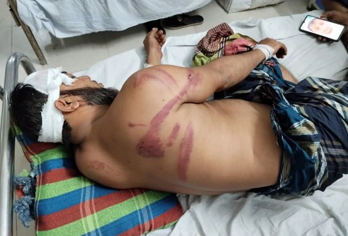 আদীতমারীতে সরকারি জমি বরাদ্দ পেয়ে বিপত্তি, সন্ত্রাসী হামলায় শিশুসহ একই পরিবারের ৪ জন রক্তাক্ত